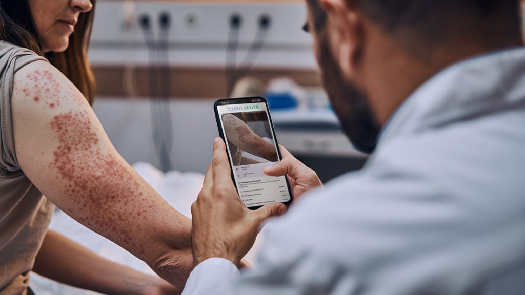 Montaje IA urticaria